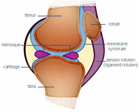 prothese-genou - Mon arthrose