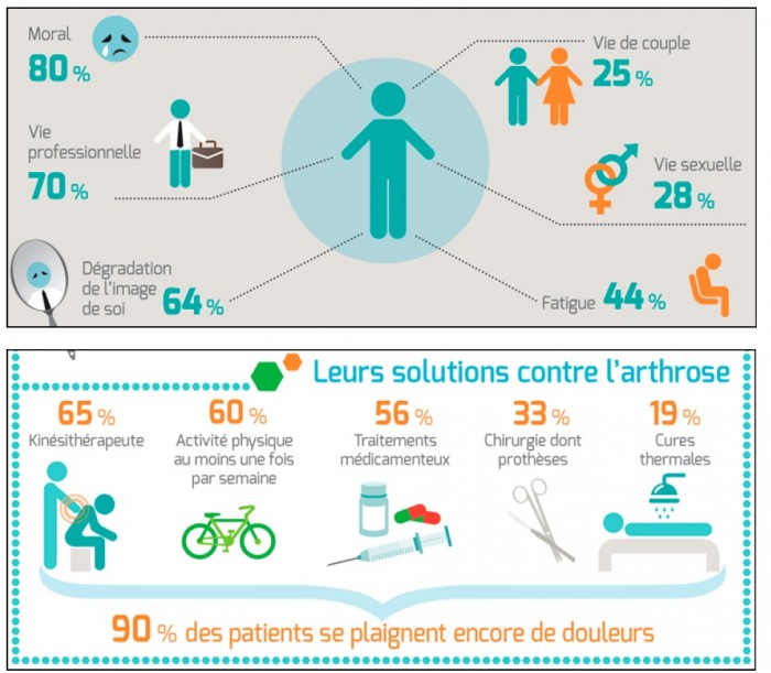 arthrose-infographie