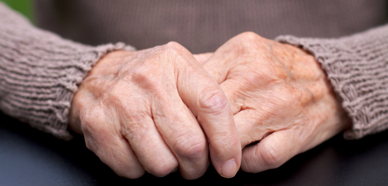 L’intérêt des corticoïdes dans l’arthrose érosive des mains