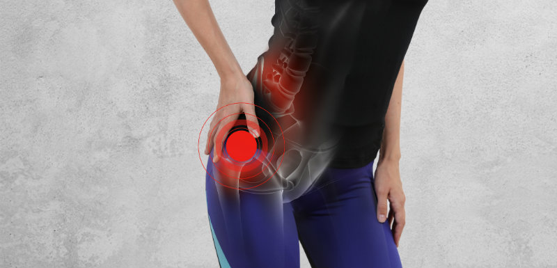 Quelle est la prise en charge recommandée pour l’arthrose de hanche ?