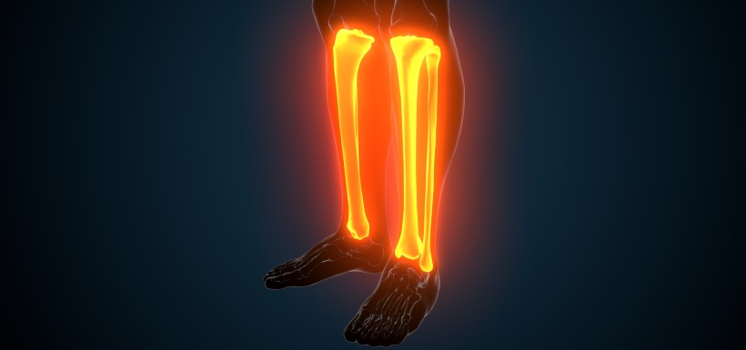 Arthrose du genou et ostéotomie : une pratique trop peu utilisée