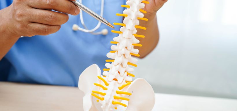 Arthrose rachidienne : guide prévention et bien-être pour la santé de votre colonne